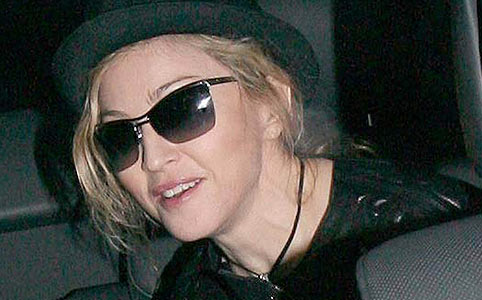 Döbbenet! Madonna  52 millióért plasztikáztatja magát