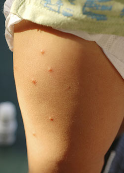 Nyári gyermekbalesetek – mire figyeljünk?