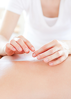 Győzd le a betegséget akupunktúrával!