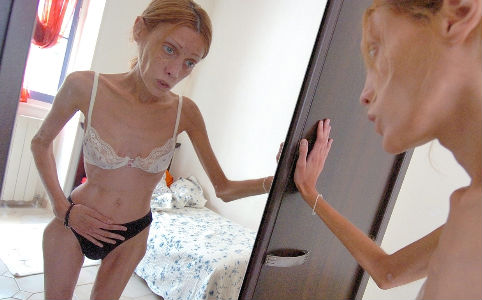 Megölték az anorexiás modellt?