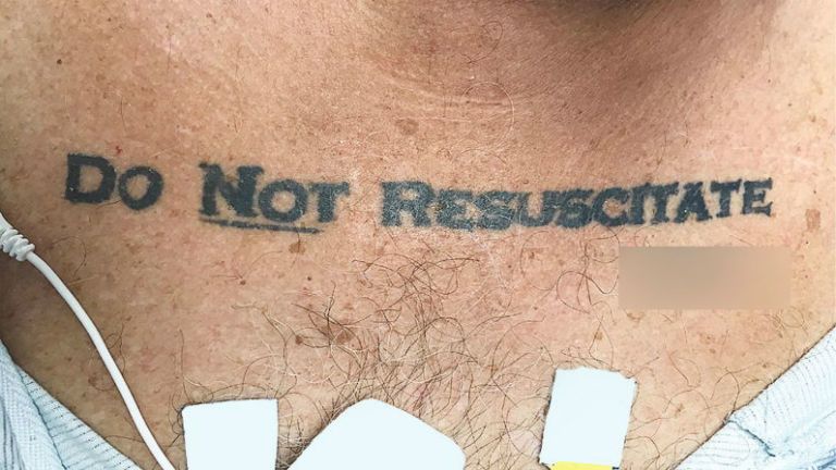 újraélesztés, etika