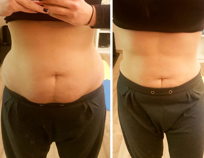 barna fanni szules után feherje dieta