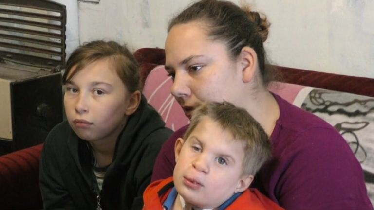 nyúlszájú kisfiú (forrás: TV2)