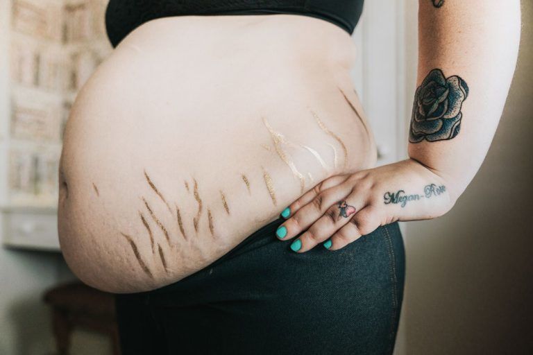 szülés utáni testkép fotósorozat