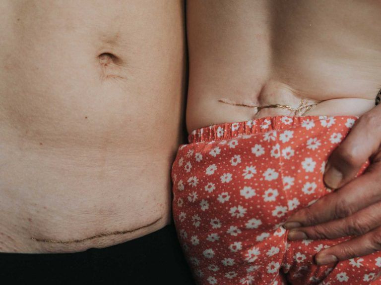 szülés utáni testkép fotósorozat