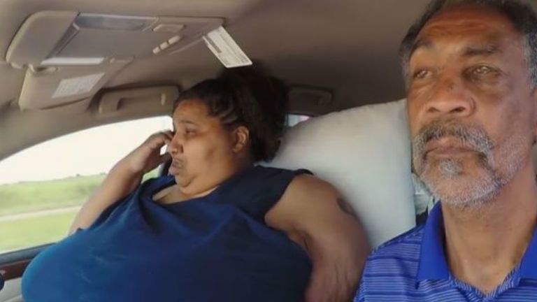 túlsúly modell plus size harc betegség