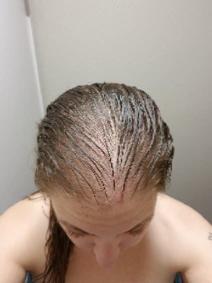 Mutatopolicisztás ovárium, pcos, hormon zavarm azt a több mint 3 kilós cisztát, ami 17 éves koromban gyakorlatilag felrobbantotta az egyik petefészkemet. Nos, ez a meglehetősen drámai kezdete az én PCOS-es kalandomnak.