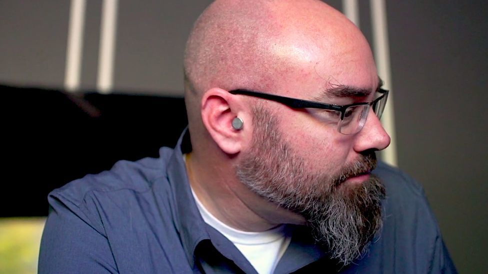 Rich Lee fülébe fülhallgató-implantátumot ültetett (Fotó: BBC)