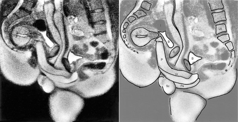 mri szex tudomány vizsgálat