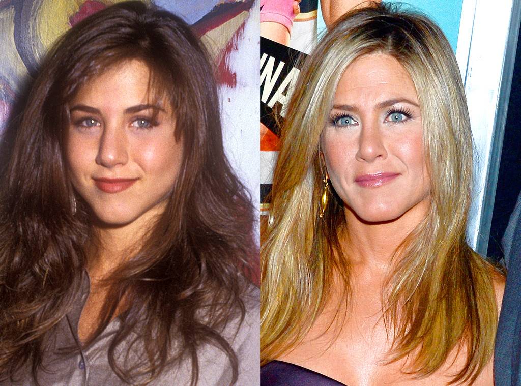 orrplasztika, jennifer aniston