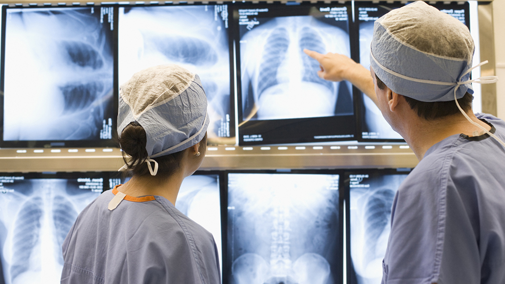 A tüdőgyulladás idős korban még veszélyesebb.