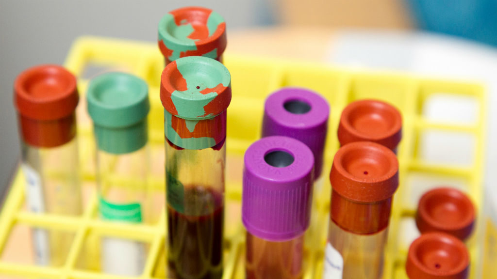 A tesztcsík darabja nettó 3900 forintba kerül majd. Fotó: National Cancer Institute on Unsplash