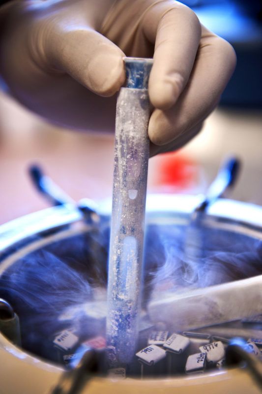 A mintát fagyasztják, majd felolvasztják, és mindkettő sejtveszteséggel járhat (fotó: getty images)