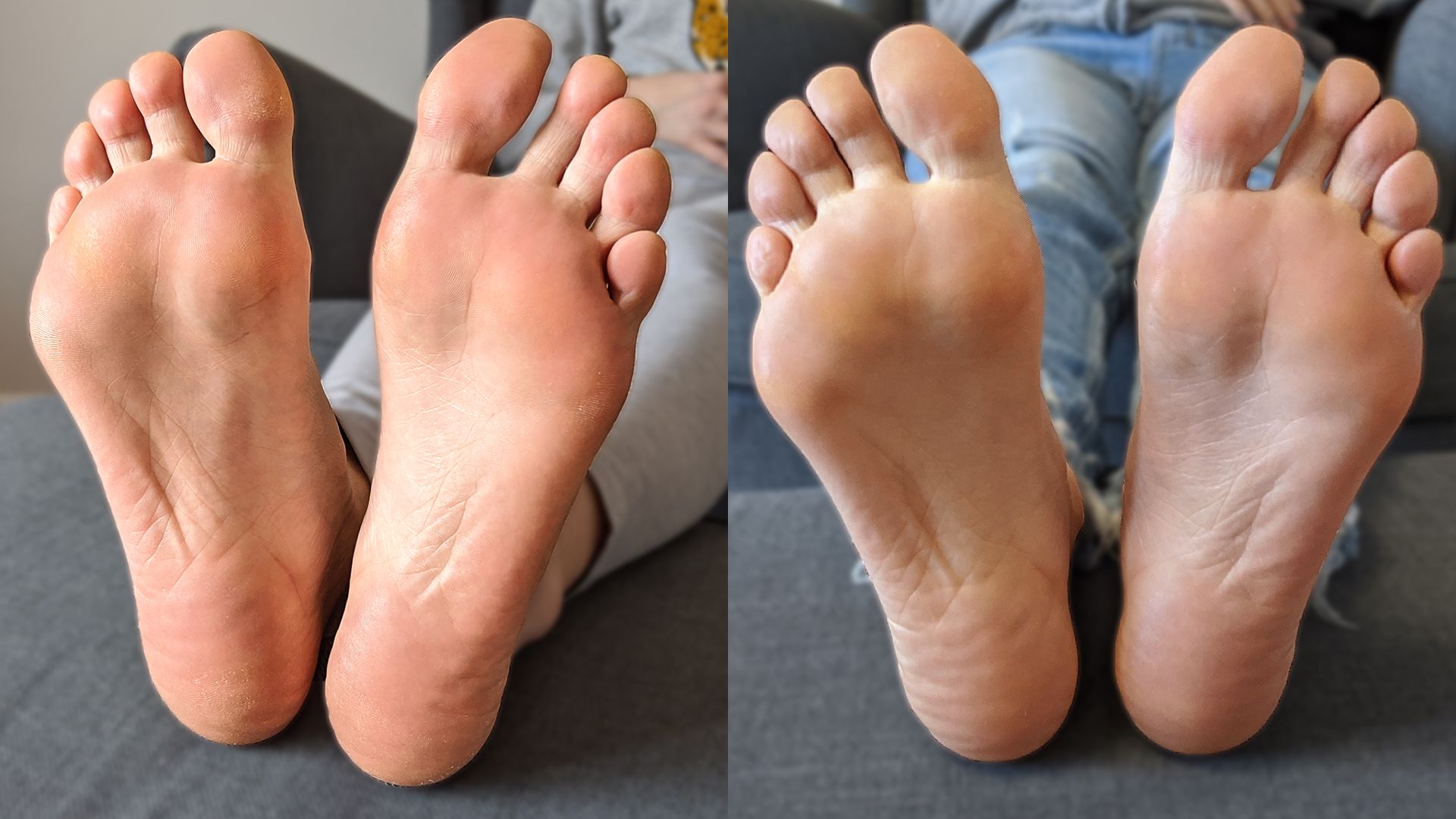 Talphámlasztás előtt és után: ennyit változott talpaim állapota a hámlasztó zokni használatától.
