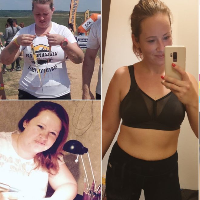 Anikó nem mert kimenni az utcára mozogni, mert félt, hogy ki fogják nevetni (Fotó: magánarchívum)