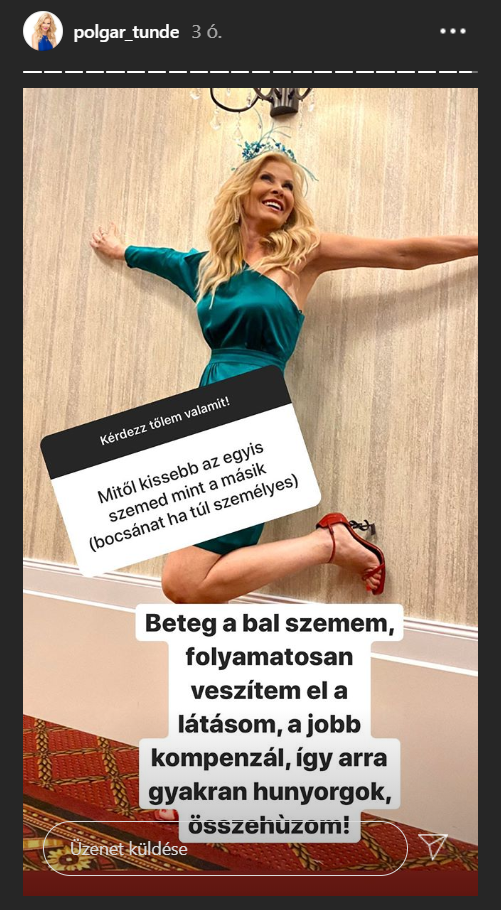 Polgár Tünde őszintén válaszolt egy rajongó kérdésére