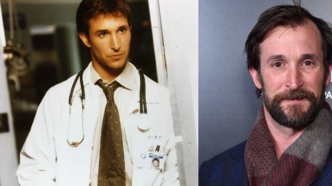 Noah Wyle, azaz Carter doki akkor és most.