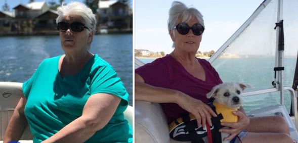 Linda első csípőműtétje után kezdett drasztikus fogyókúrába.