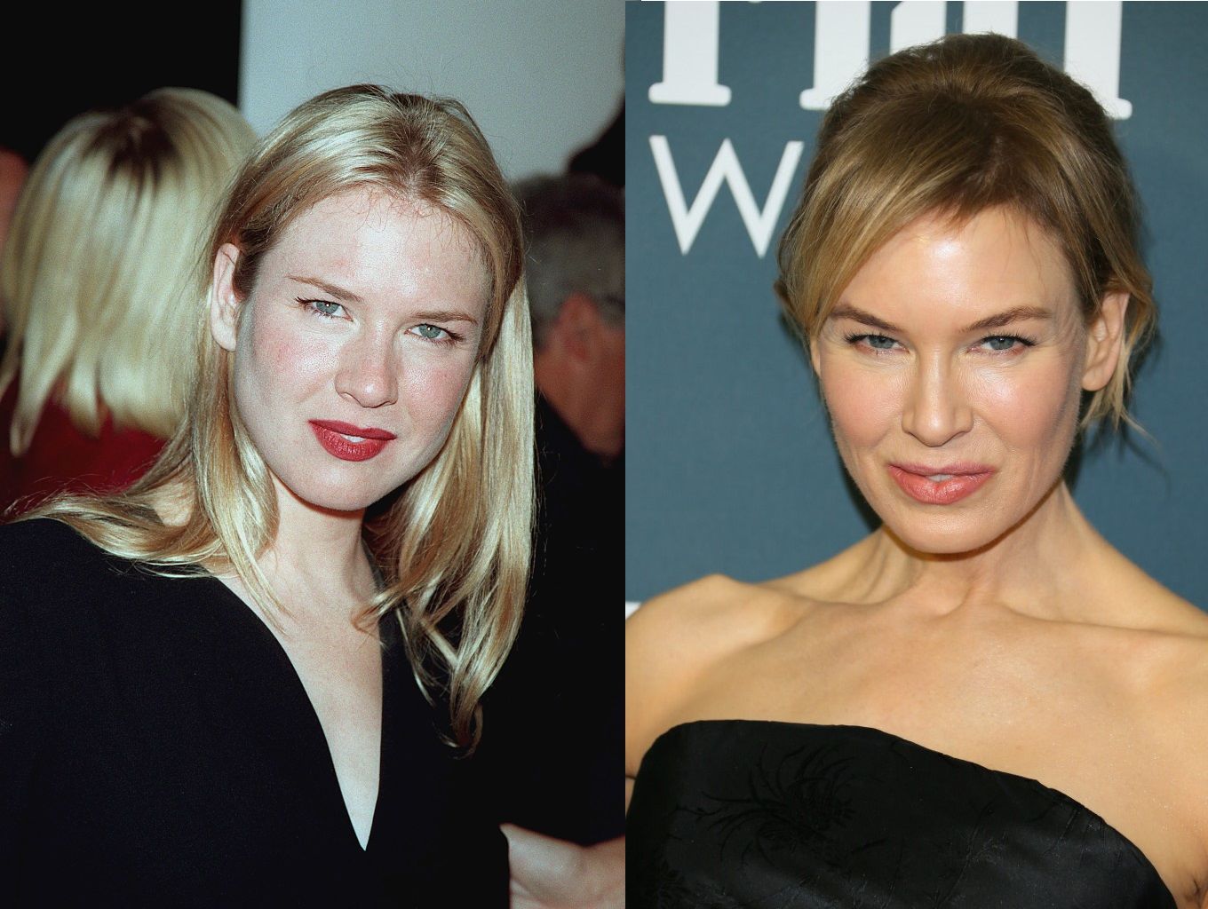 Renee Zellweger plasztika előtt