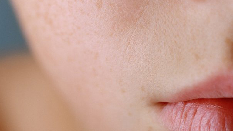 BIODERMA vízhiányos bőr