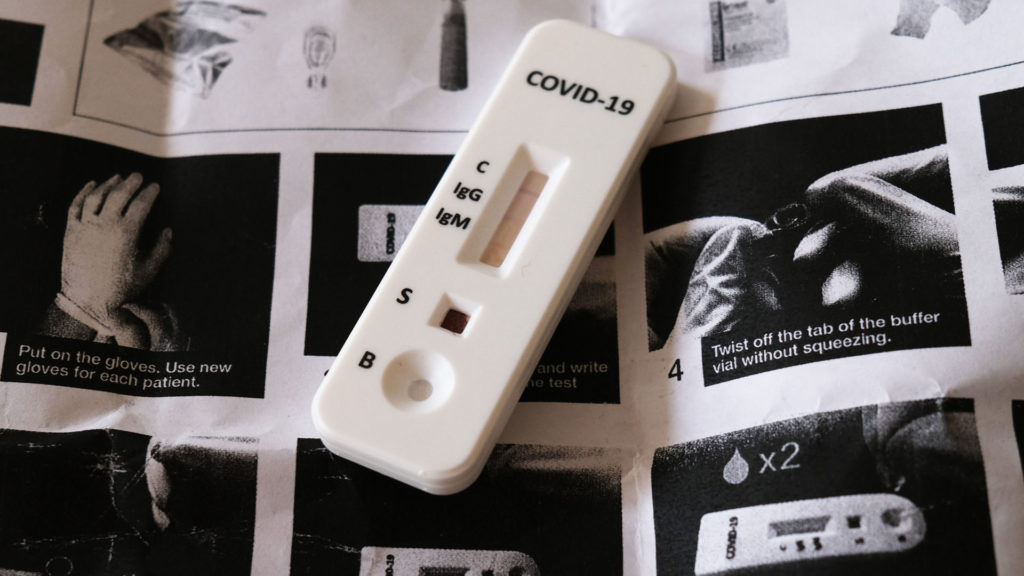 Egy hibás koronavírus-teszteredmény súlyos következményekkel járhat