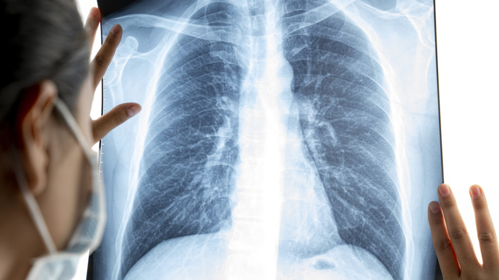 Ezekkel a légzőgyakorlatokkal rehabilitálhatják magukat a covid-fertőzöttek