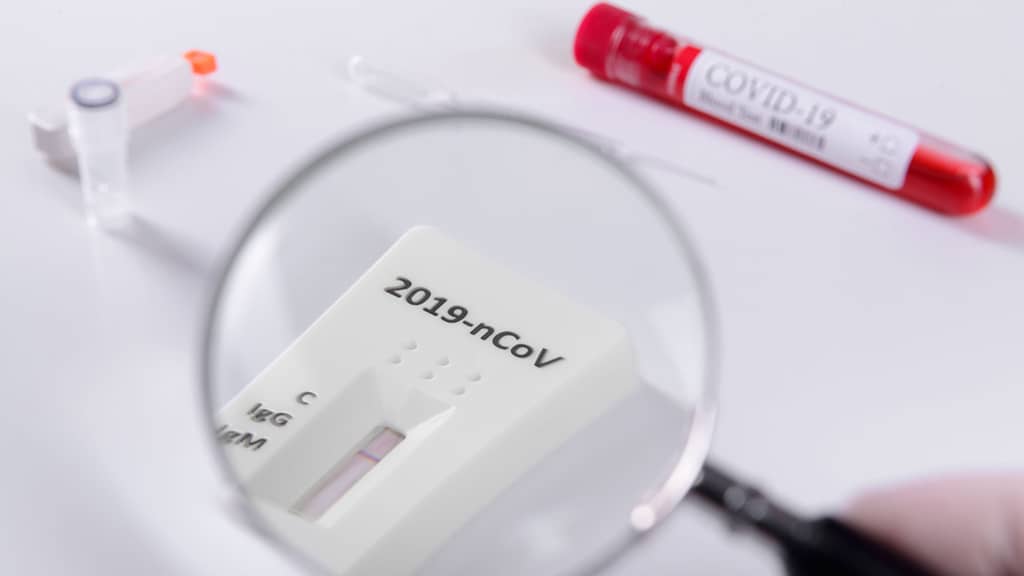 Melyik covid teszt, kinek javasolt? (X)