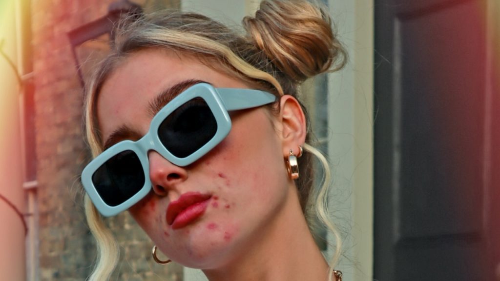 Pattanásos modellek a H&M hirdetésében