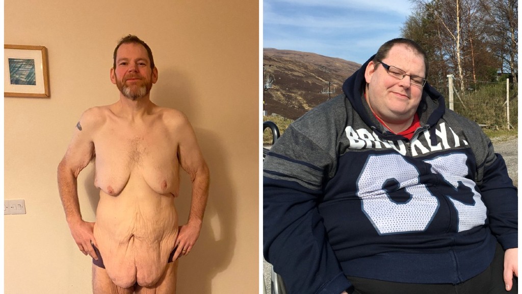 Paul Tuthill a fogyás után és előtt (fotó: Profimédia)