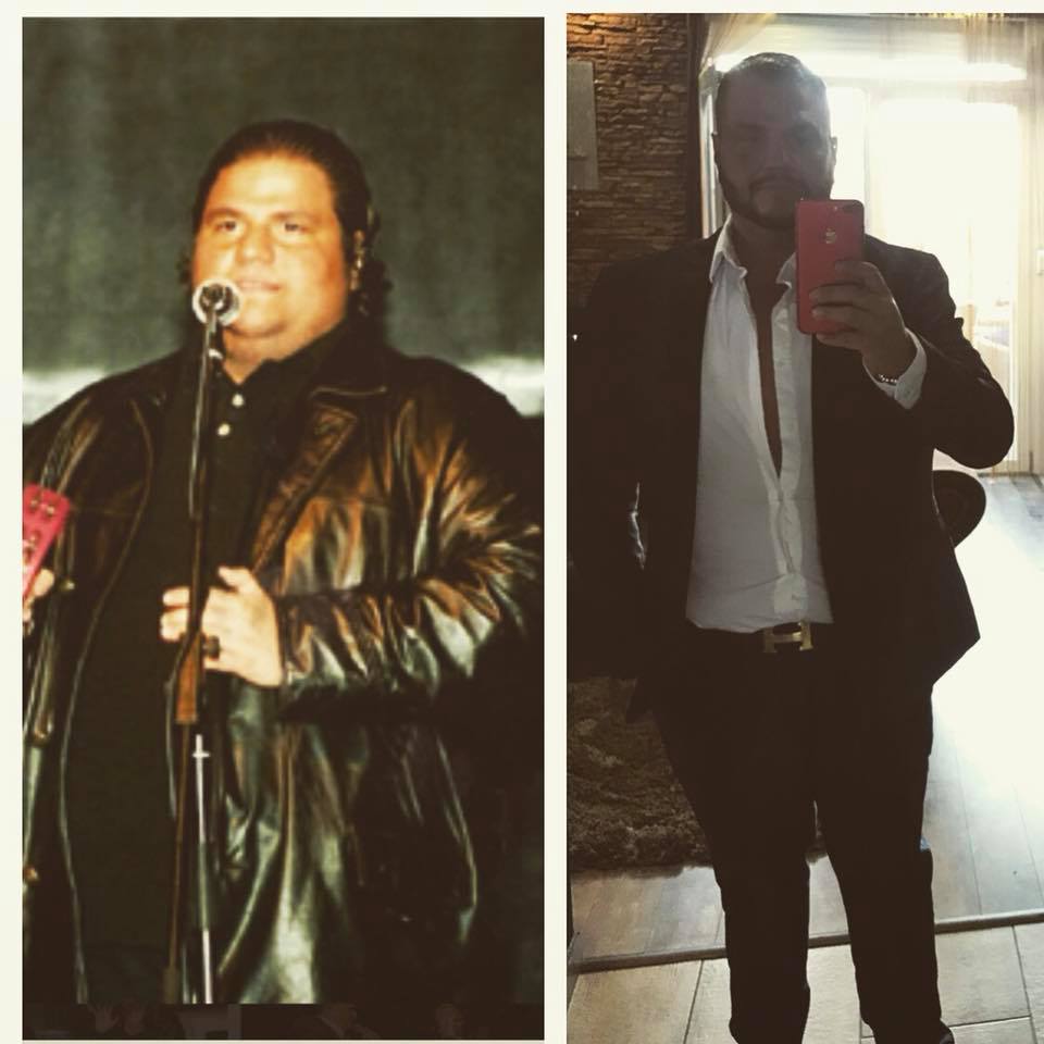 Sztárok nagy fogyása