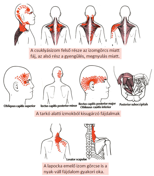 A banyapúp csúnya és fáj, de ahhoz nem eléggé, hogy komolyan vegyük