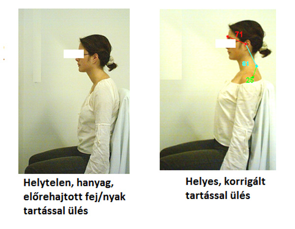 A banyapúp csúnya és fáj, de ahhoz nem eléggé, hogy komolyan vegyük