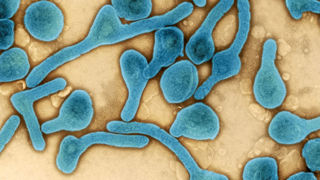 Gyógyíthatatlan vírus megjelenésére figyelmeztet a WHO