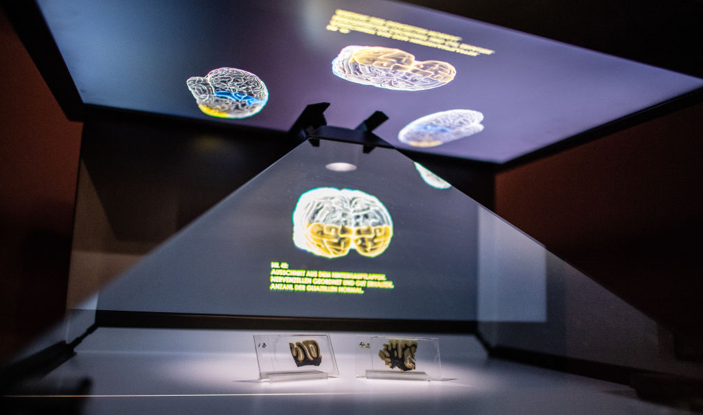 Mütter múzeum, furcsa múzeum, Albert Enstein agya