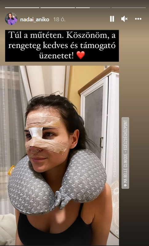 nádai anikó orrműtét