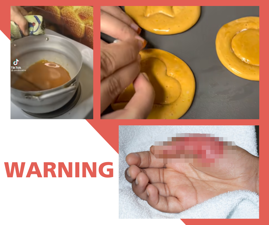 Figyelmeztet a gyerekkórház: újabb veszélyes kihívás terjed a Squid Game miatt