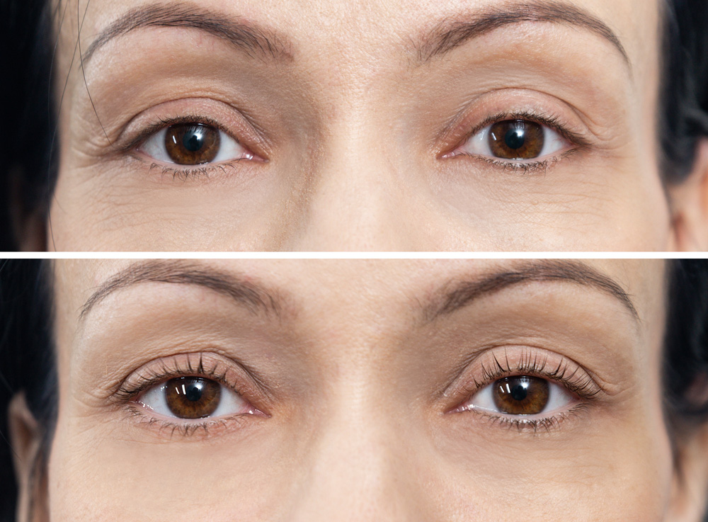 Szempillákat fel! - Kipróbáltuk a szempillaliftinget