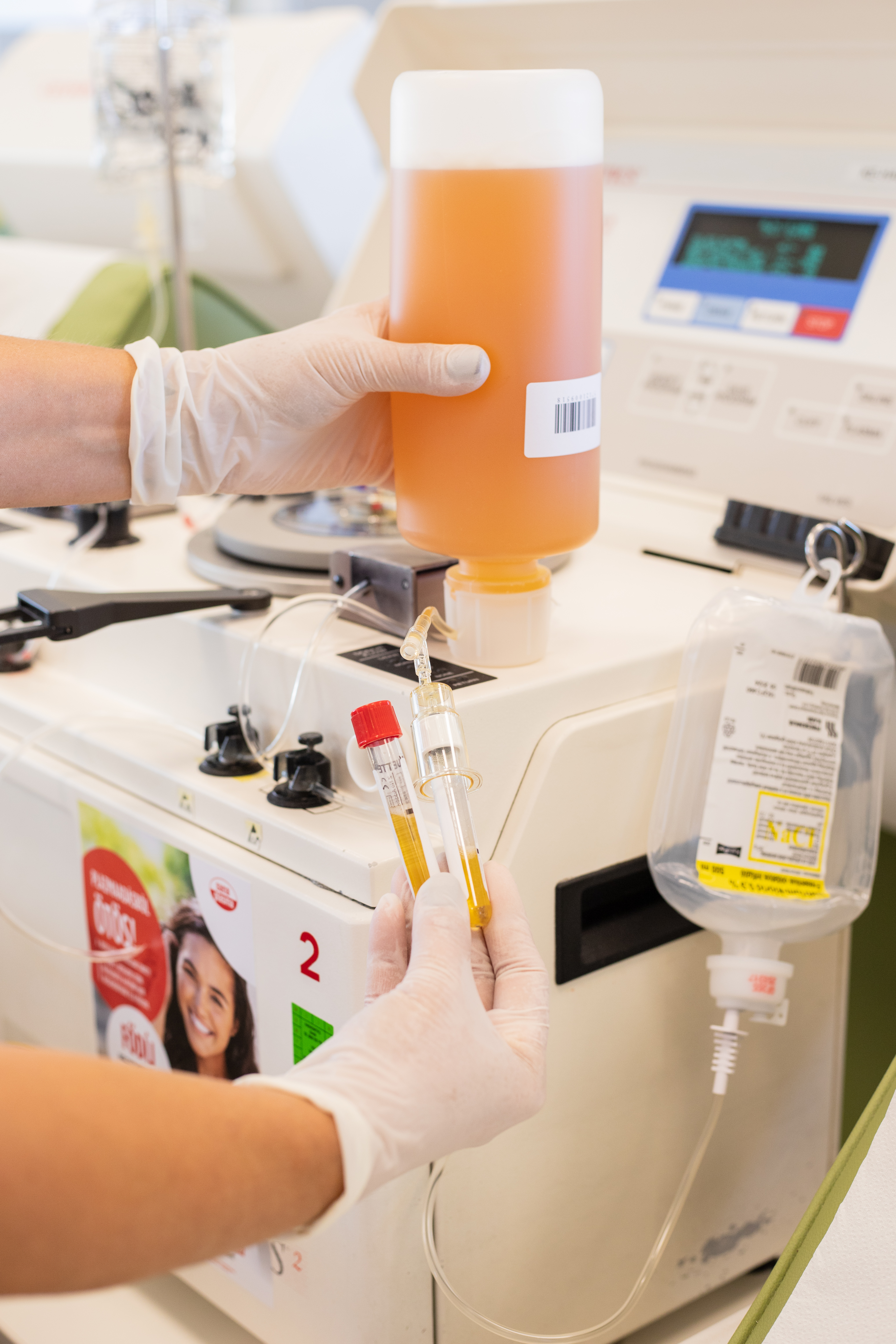 Mintavétel a levett vérplazma ellenőrzése céljából