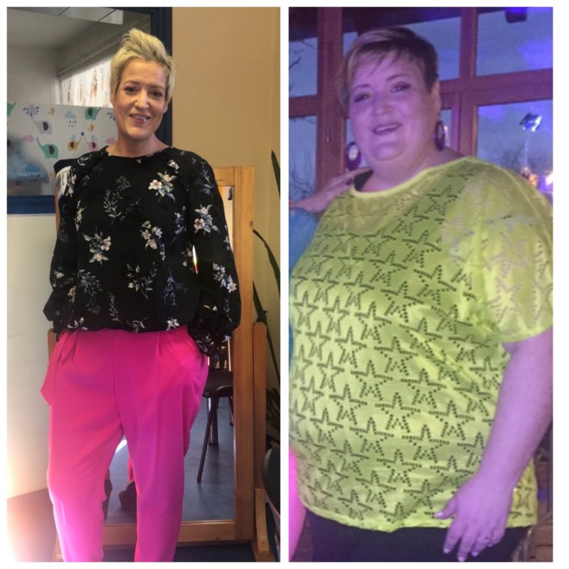 nagy fogyás gyomorszűkítő műtét óvónő