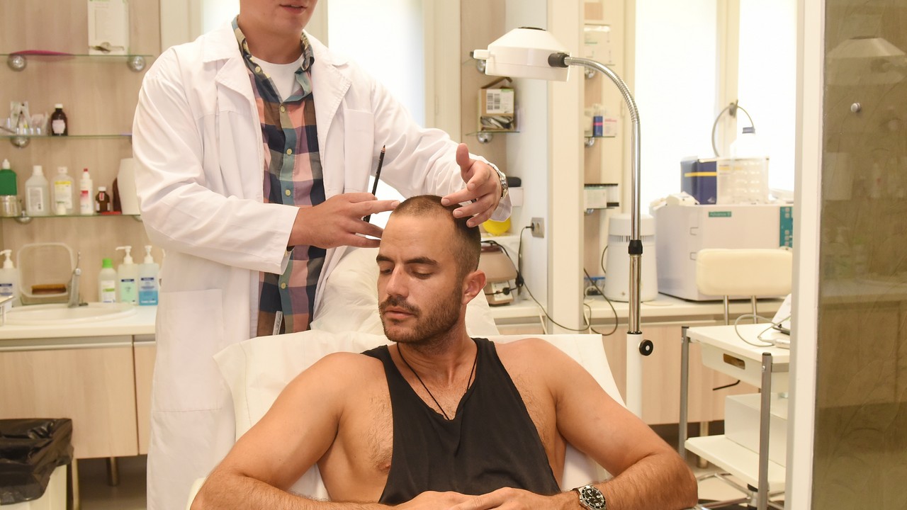 Törőcsik Dániel hajbeültetésen