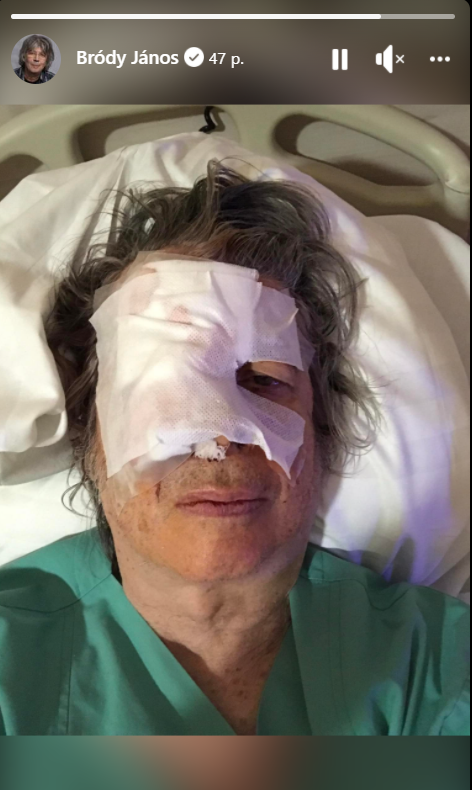 bródy jános műtét
