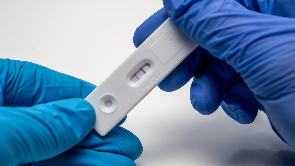 Pozitív koronavírus-teszt