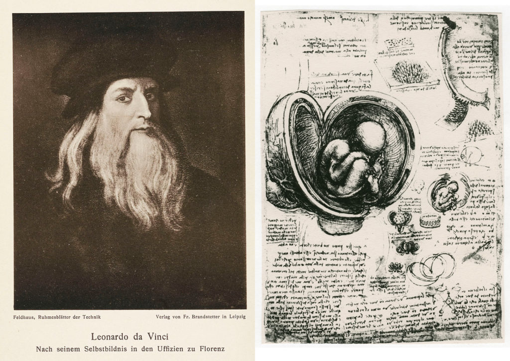 Anatómiai vázlat egy emberi magzatról az anyaméhben Leonardo da Vinci tollából (Fotó: Da SSPL/Getty Images)