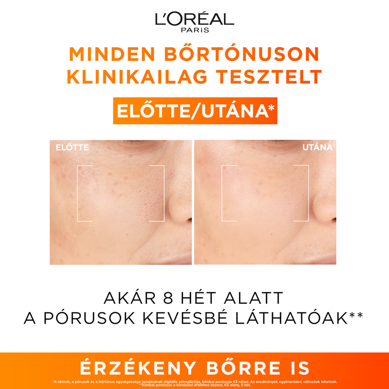 C-vitamin egy igazi sztárösszetevő a szervezet és a bőr számára 