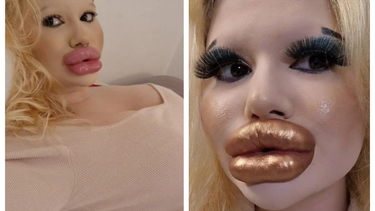 a világ legnagyobb ajkú nője cover