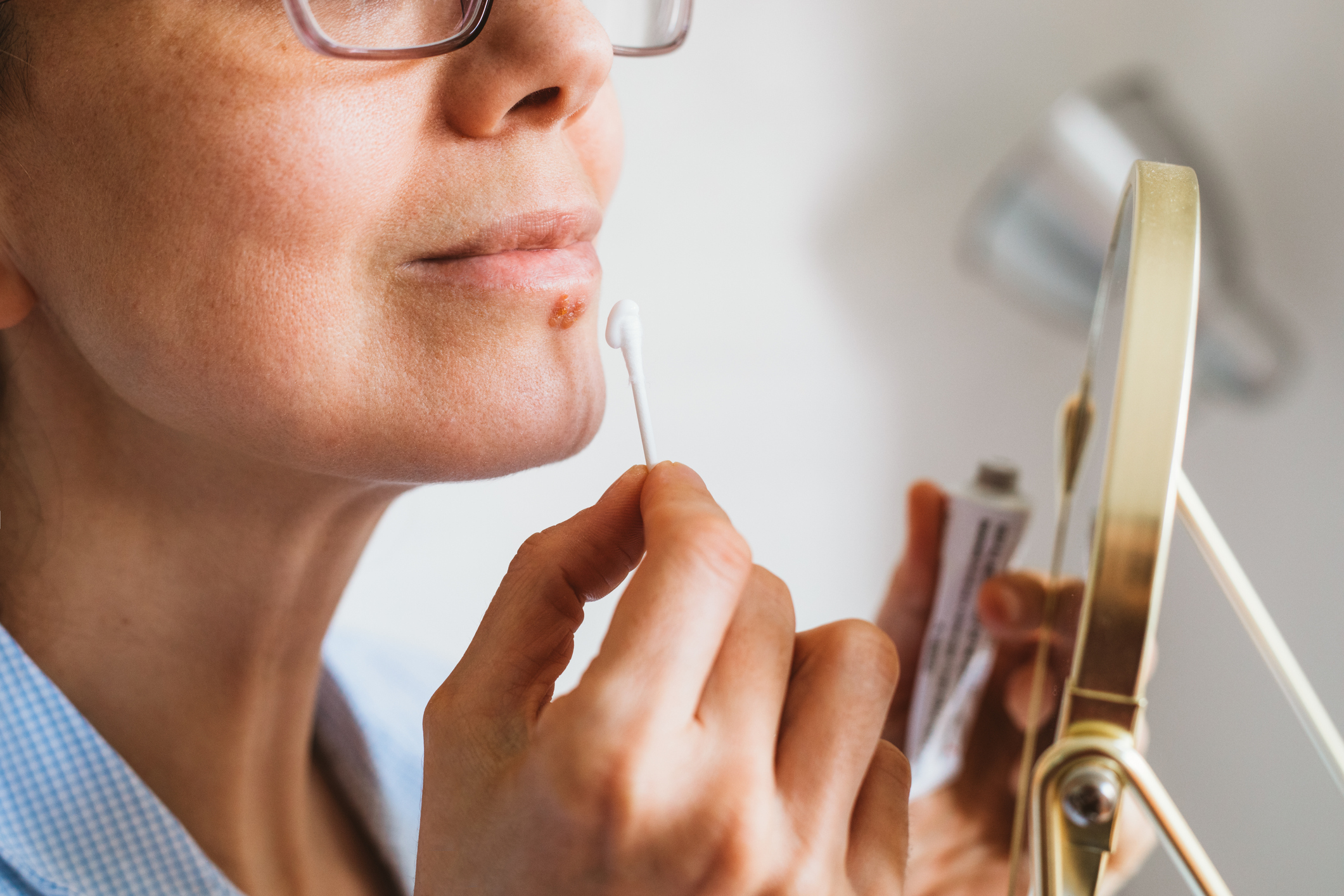 Egy nő egy kisebb tükörben nézve keni be kenőccsel a herpeszét.