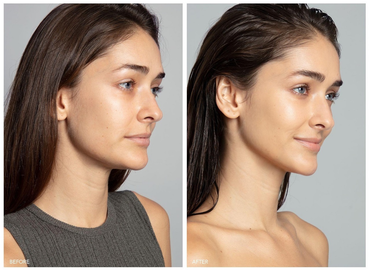 A képen: A BEAR 2 használata előtt és után