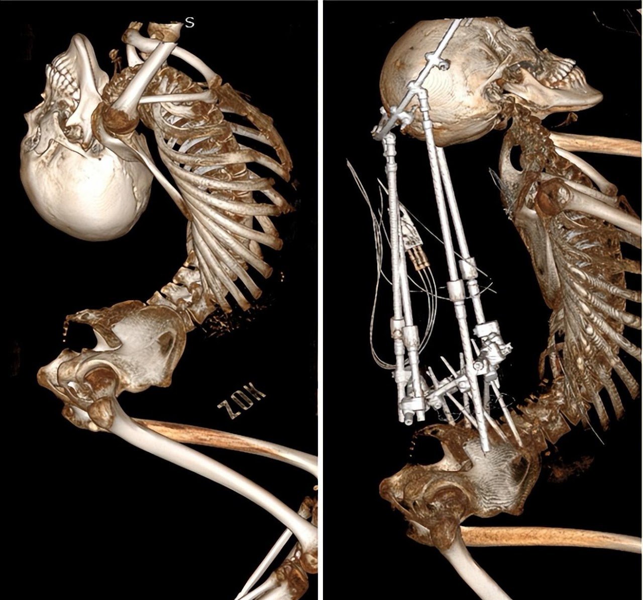 Jiang Yanchen, az összehajtogatott fiú