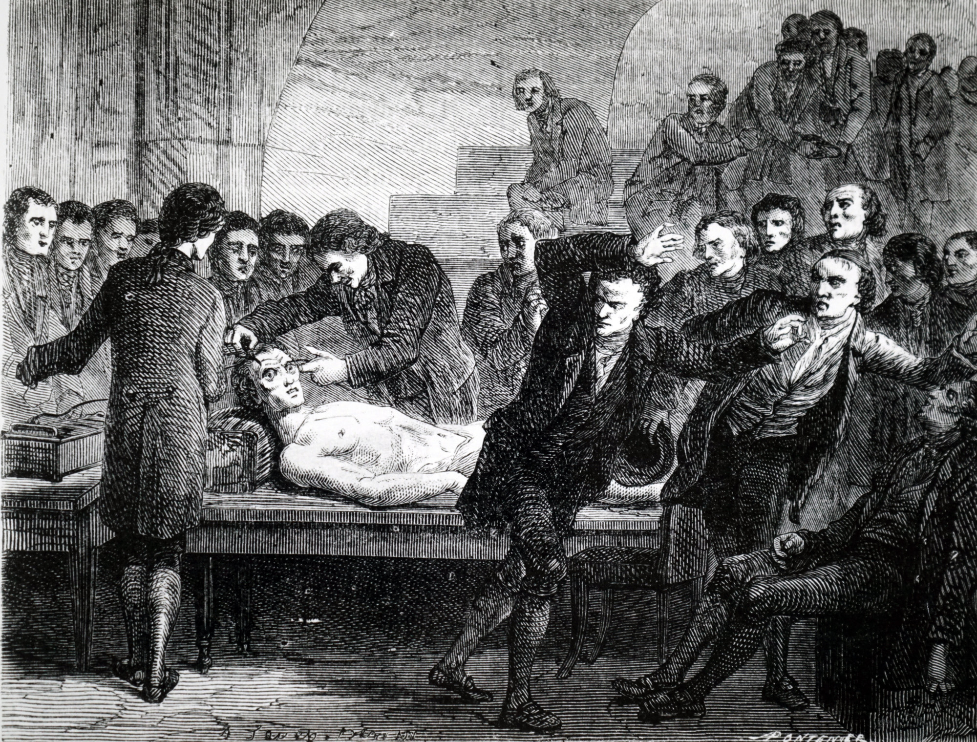 Frankenstein-kísérletek