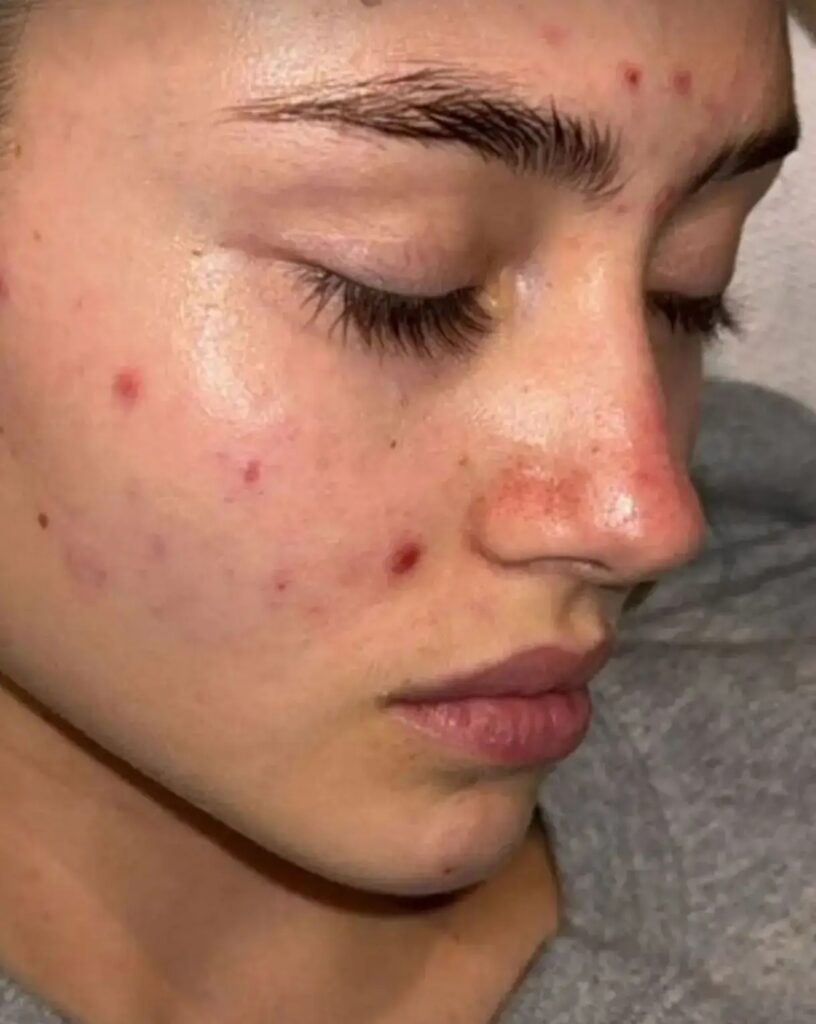 Leni Klum pattanásos arca